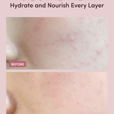 PURIFYING HYDRATING TONING ESSENCE