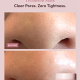 OILY ACNE-PRONE SKIN MICROBIOME BALANCING SET