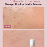 COMBINATION SKIN OIL-WATER BALANCING & STABILIZING SET
