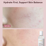 DRY SKIN INSTANT AQUA-BOMB HYDRATION SET